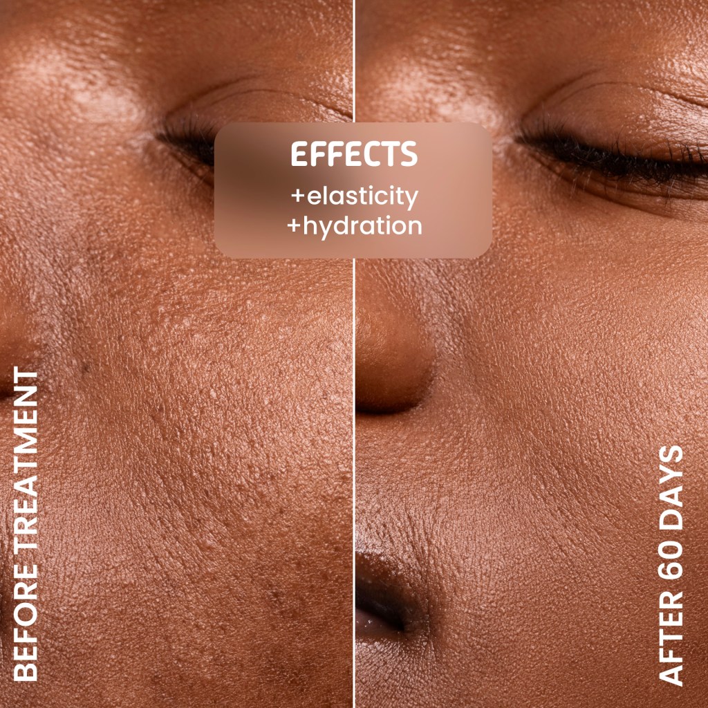 Side-by-side comparison of skin before treatment and after 60 days, highlighting improvements in elasticity and hydration.